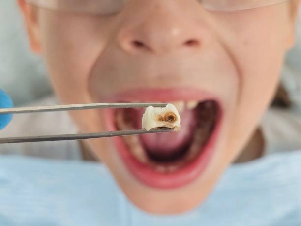Best Pediatric Emergency Dentist in Stinnett, TX